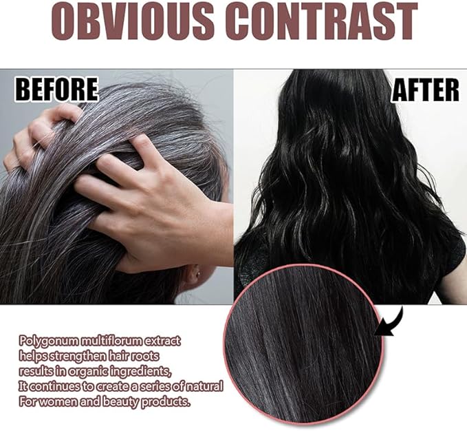 Polygonum Soap for Hair Growth & Anti-Hair Fall – EELHOE Original